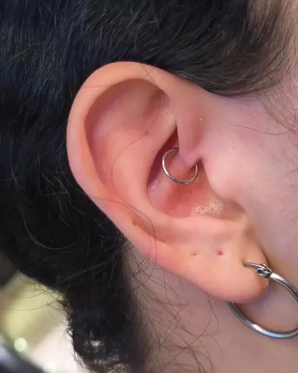 Oreja con un aro en el daith y un aro en el lóbulo